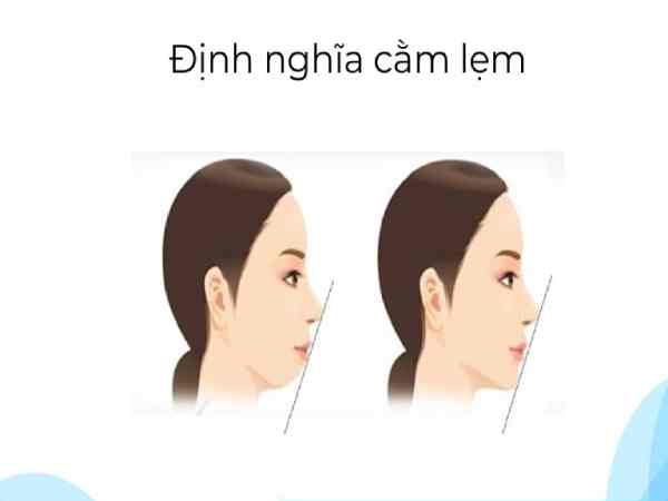 Cằm lẹm tướng số ở phụ nữ Cằm lẹm tướng số ở phụ nữ