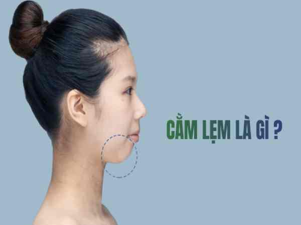 Tướng cằm lẹm là gì?  Tướng cằm lẹm là gì?