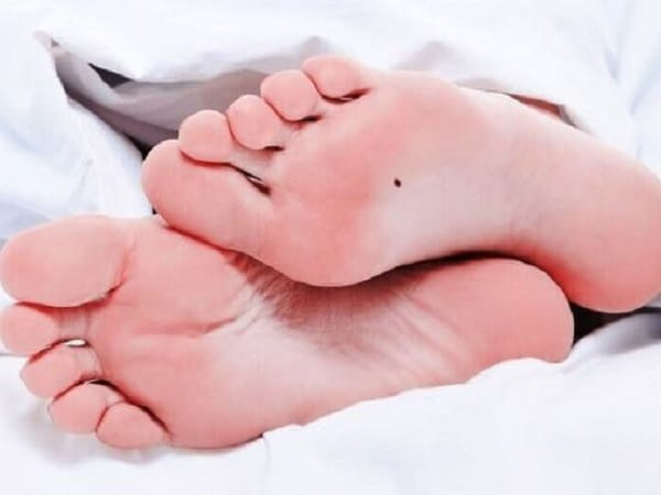 Nốt ruồi ở gan bàn chân phải có ý nghĩa ra sao?