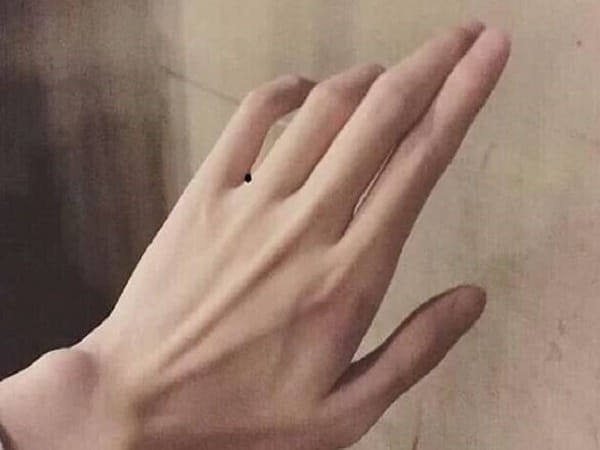Nốt ruồi ở kẽ ngón tay út – Vận quý nhân và tài lộc