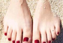 nốt ruồi ở ngón chân áp út