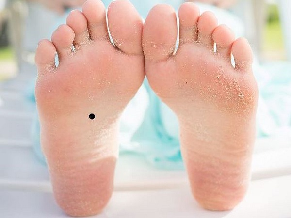 Ý nghĩa chung của mụn ruồi ở gan bàn chân