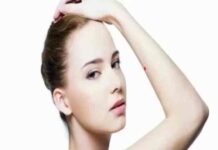 nốt ruồi son trên cánh tay