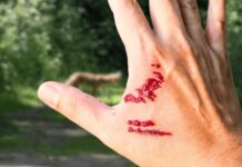 Nằm mơ thấy người khác chảy máu điềm gì, con gì phát tài?